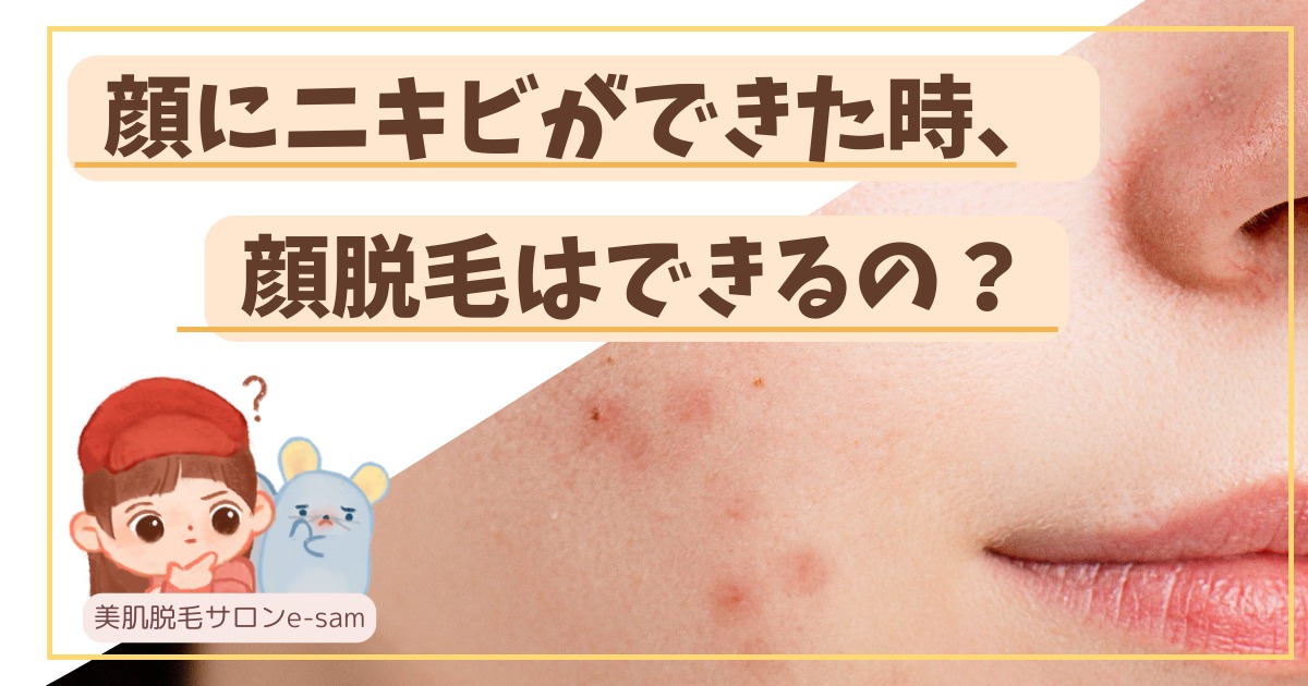 顔にニキビができた時、顔脱毛はできるの？